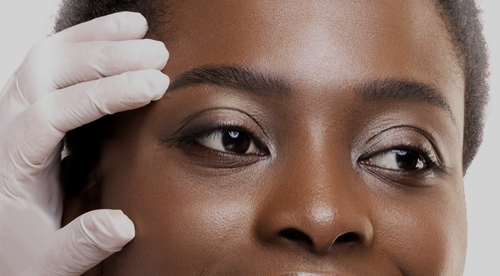 hormones and glaucoma hormones and glaucoma